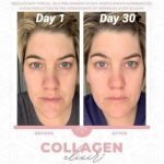 collagen12