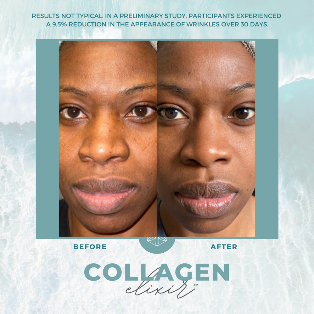 Collagen Transformation 40 - Healthy Body Team